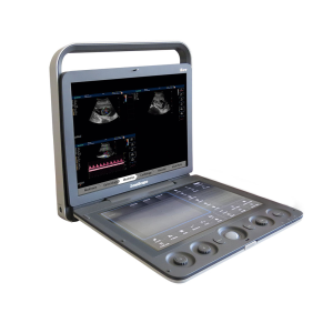 Ecógrafo doppler color Sonoscape S9 con 1 transductor volumétrico 3D/4D
