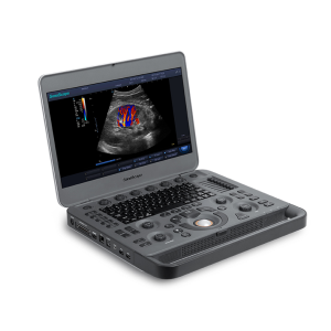 Ecógrafo doppler color Sonoscape X3 con 1 transductor a elección